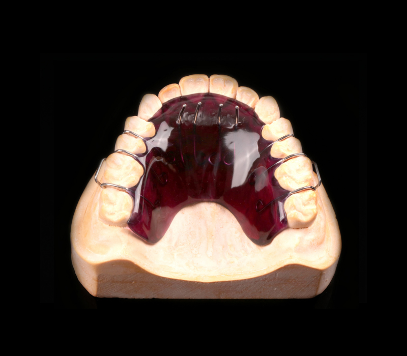 不良习惯矫治器(固定舌栏舌刺) - 广东名洋